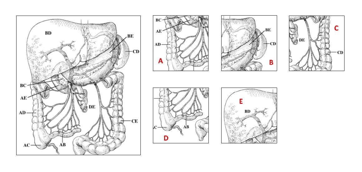 Beispielaufgabe Muster zuordnen