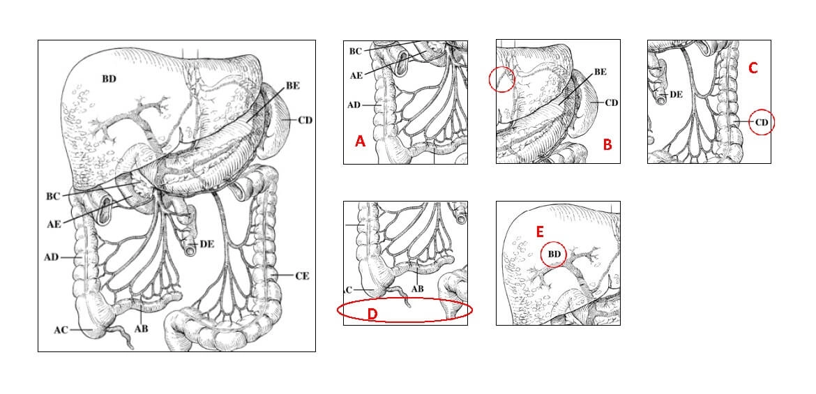 Lösung zu Beispielaufgabe 